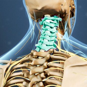 cervical