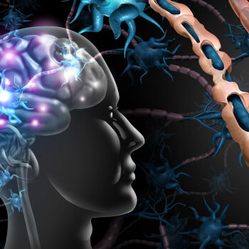 1800x1200 covid19 and multiple sclerosis ref guide 35ak6c6j5znvnm71sfnl4i32pwuel5q5hqhkrkg51uoeg7qwc