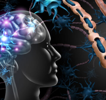 1800x1200 covid19 and multiple sclerosis ref guide 35ak6c6j5znvnm71sfnl4i32pwuel5q5hqhkrkg51uoeg7qwc