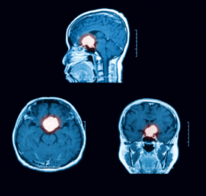 asfafad 39s0pzoidb0i18copf1pfev4fts0ukrg2x7zja0ujlt73h0j0 1