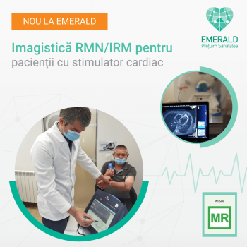 verificare stimulator cardiac