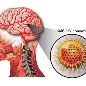 encephalitis 35a2xu68scoc7jn7ph60c9cfzrsn5dvsothxzkx201n5zx7n0