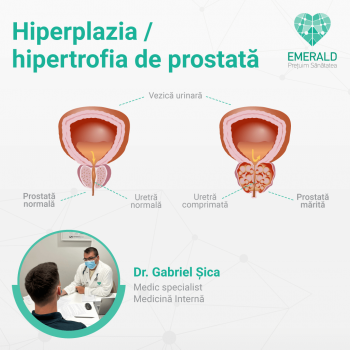 hiperplaziahipertrofia de prostata 3altuc1vpjkueu5mofif282hkelj7x8qo3eqjjdjoykvoxhpo
