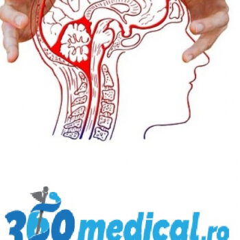 migrene 1200x545 c 34l0e3rpwaef0upssn31m5ixxq8ru8rf1ddkah5076bwj1a0c