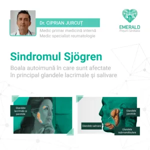 dr c jurcut sindromul sjogren 300x300 1