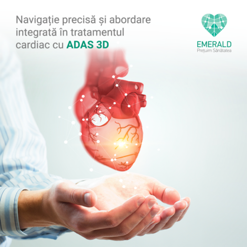 emerald articol blog 1