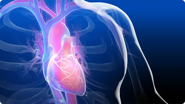 Cardiologie