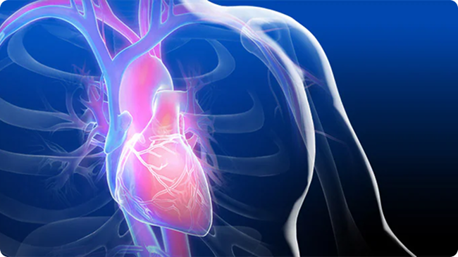 Cardiologie